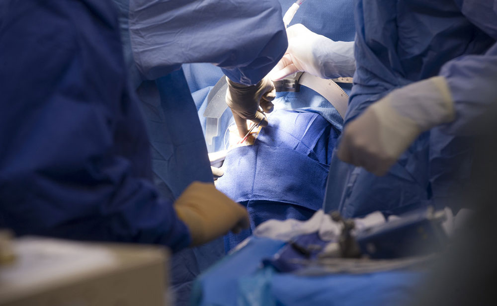 rep memon dbs surgery 2012 1000px