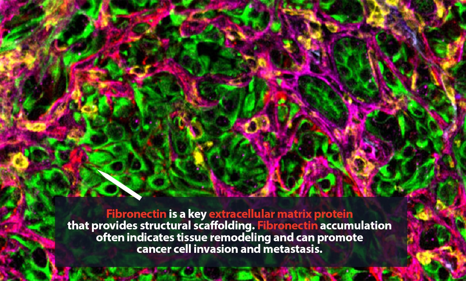 4 alt red stroma 1490x898px