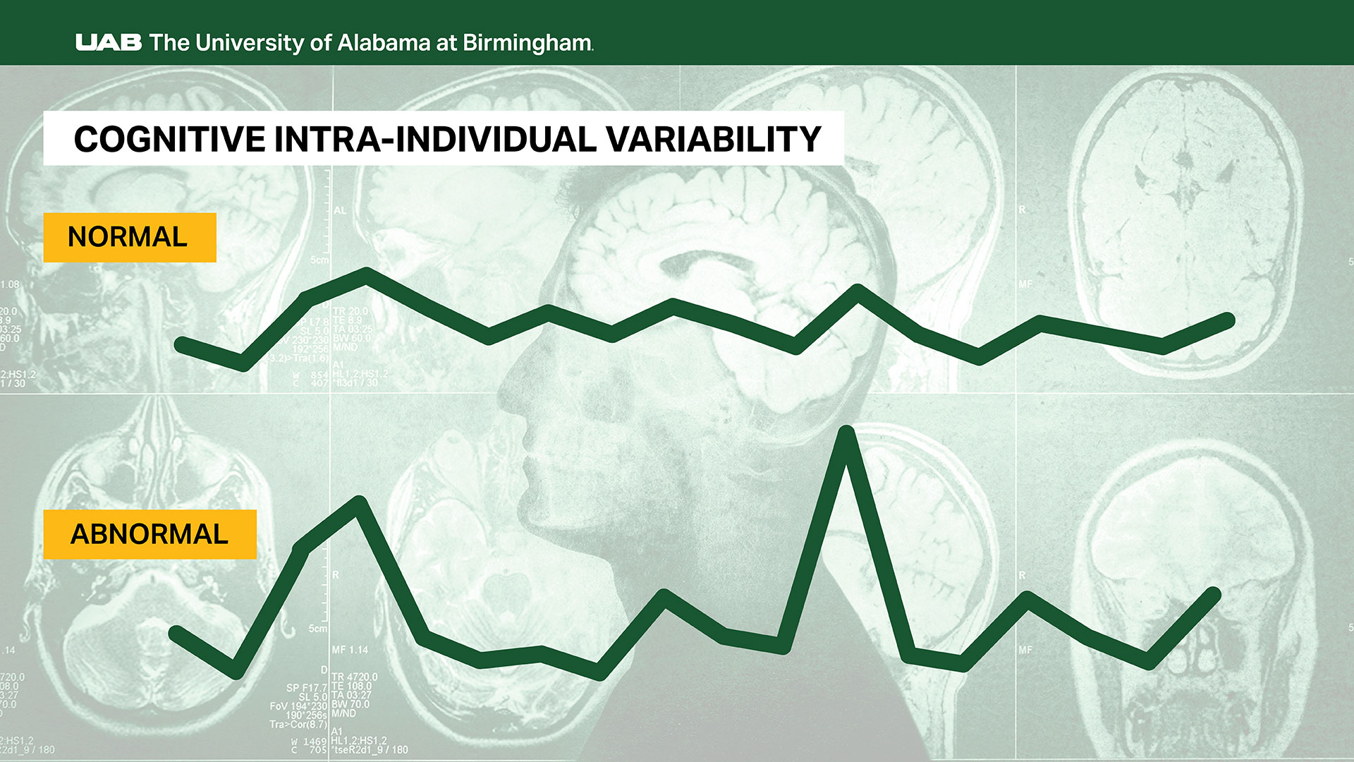 Cognitive intra-individual variability is depicted graphically as a low-peaked time series line marked normal and a time series with jagged peaks marked abnormal