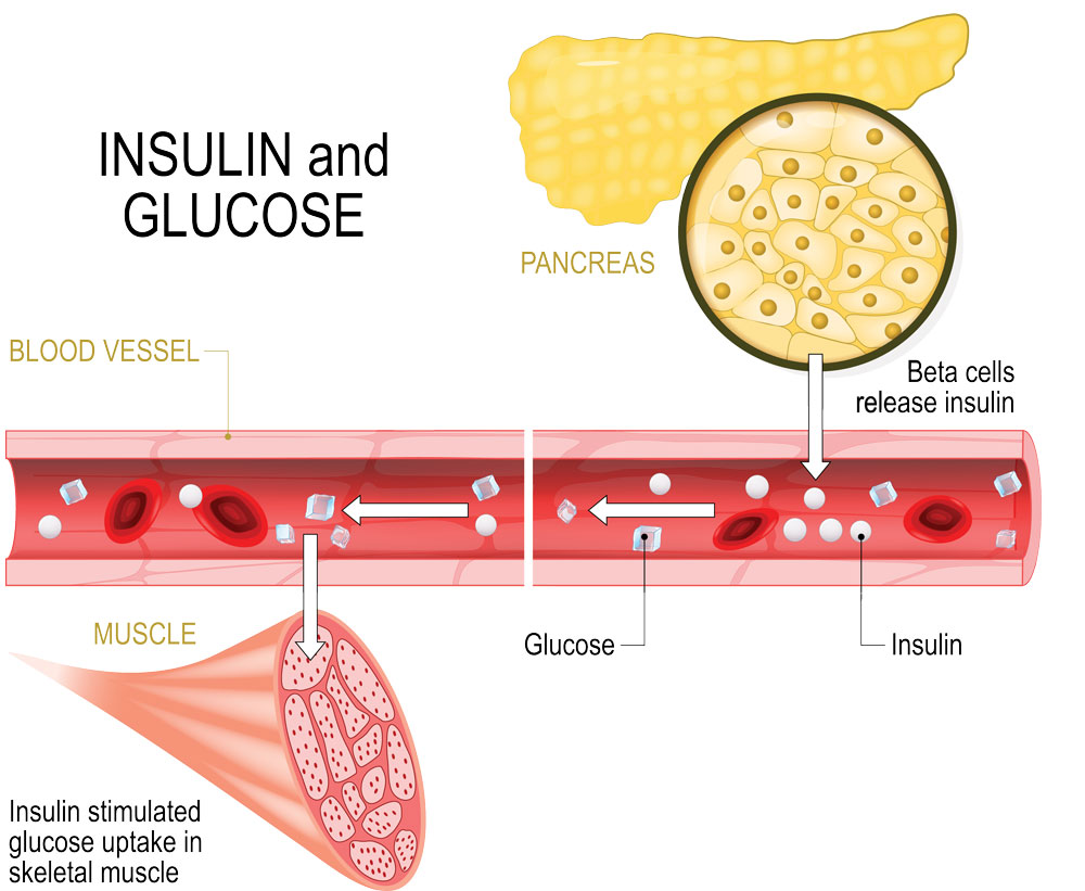 rep gower diet insulin infographic 1000px
