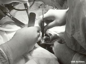 UAB pioneered transplants in Alabama