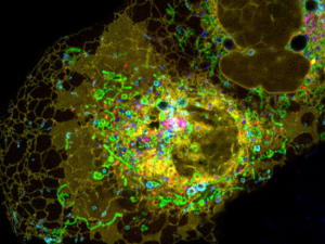 This glow-in-the-dark Trojan horse makes cancer cells build their own self-destruct switch