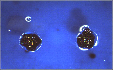 Photo of Streptococcus mutans