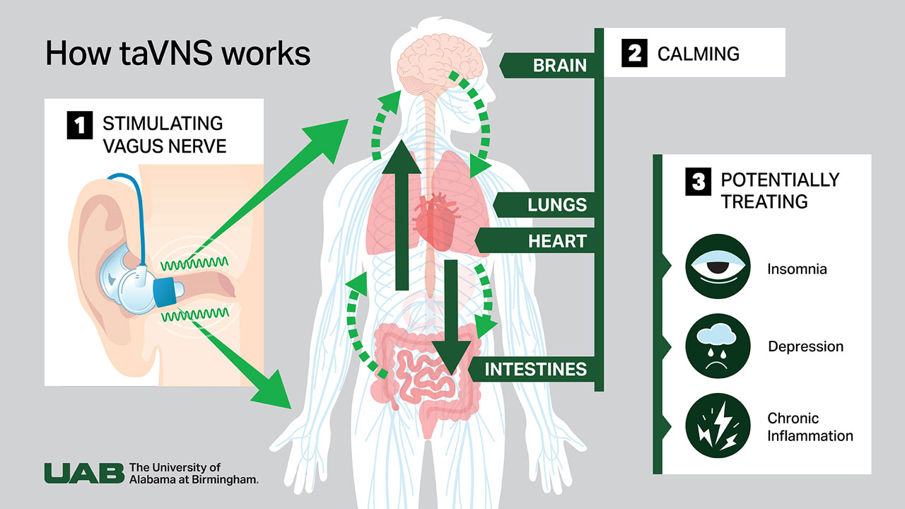 How taVNS works. First image shows a side view of the taVNS device in the ear providing electric stimulation. This is titled 1 - Stimulates vagus nerve. The second image shows a cutaway of the body, with arrows pointing to the brain and to the lower organs showing directions of stimulation. This image is titled 2 - Calming brain, lungs, heart, intestines. Third image shows 3 icons representing health conditions - a sleepy eye for insomnia, a rain cloud and sad face for depression and a lightning bolt for chronic inflammation. This image is titled 3 Potentially Treating.
