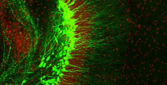 Neurogenesis in action