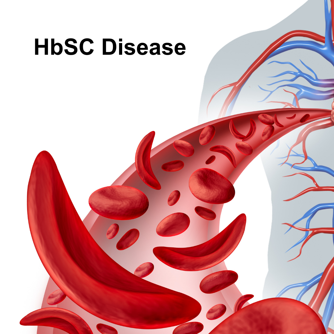 Hemoglobin Sickle Cell Disease